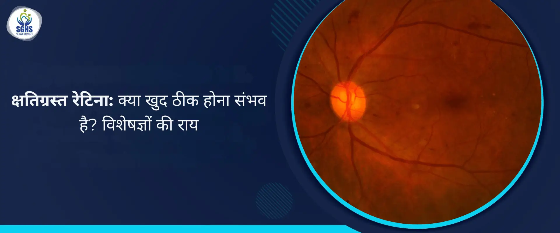 क्या क्षतिग्रस्त रेटिना खुद ठीक हो सकता है