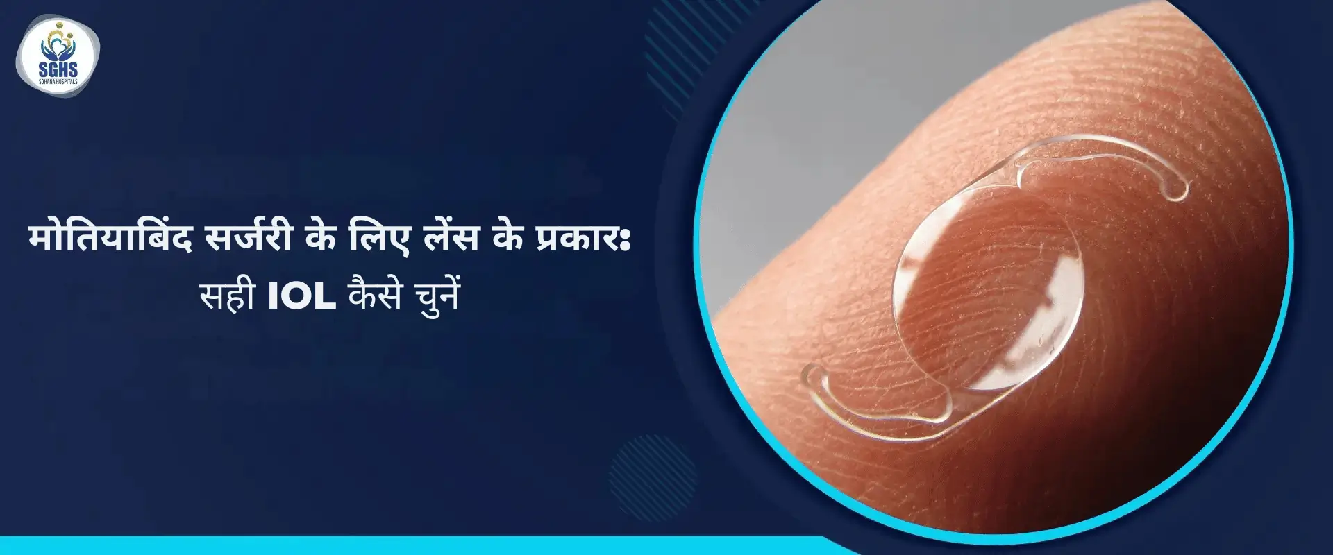 मोतियाबिंद सर्जरी के लिए लेंस के प्रकार - सही IOL कैसे चुनें