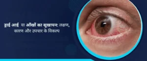 ड्राई आई या आँखों का सूखापन - लक्षण, कारण और उपचार के विकल्प