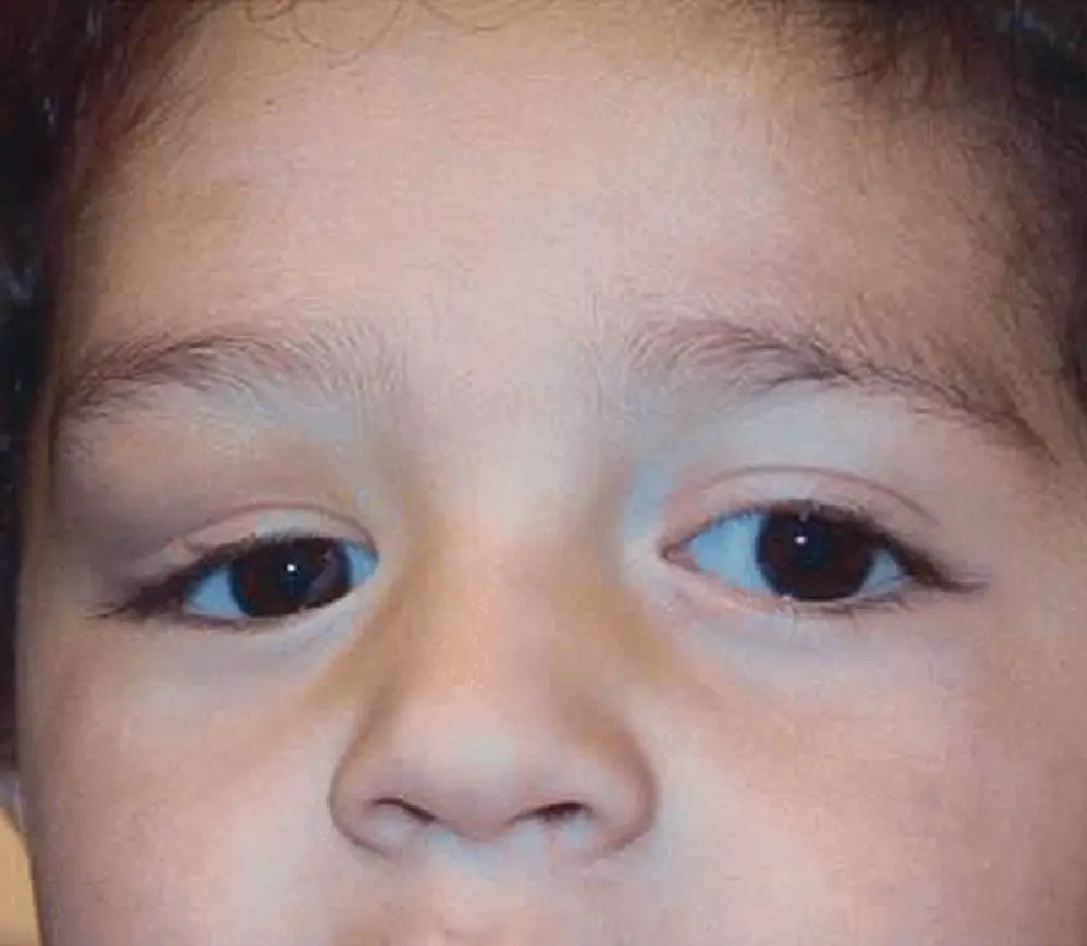 Congenital Anomalies