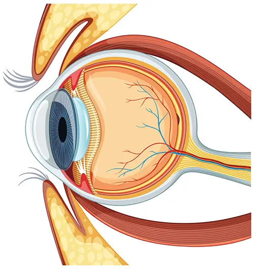 Retina Detachment problem