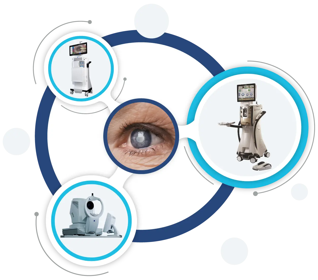 Cataract Eye Surgery