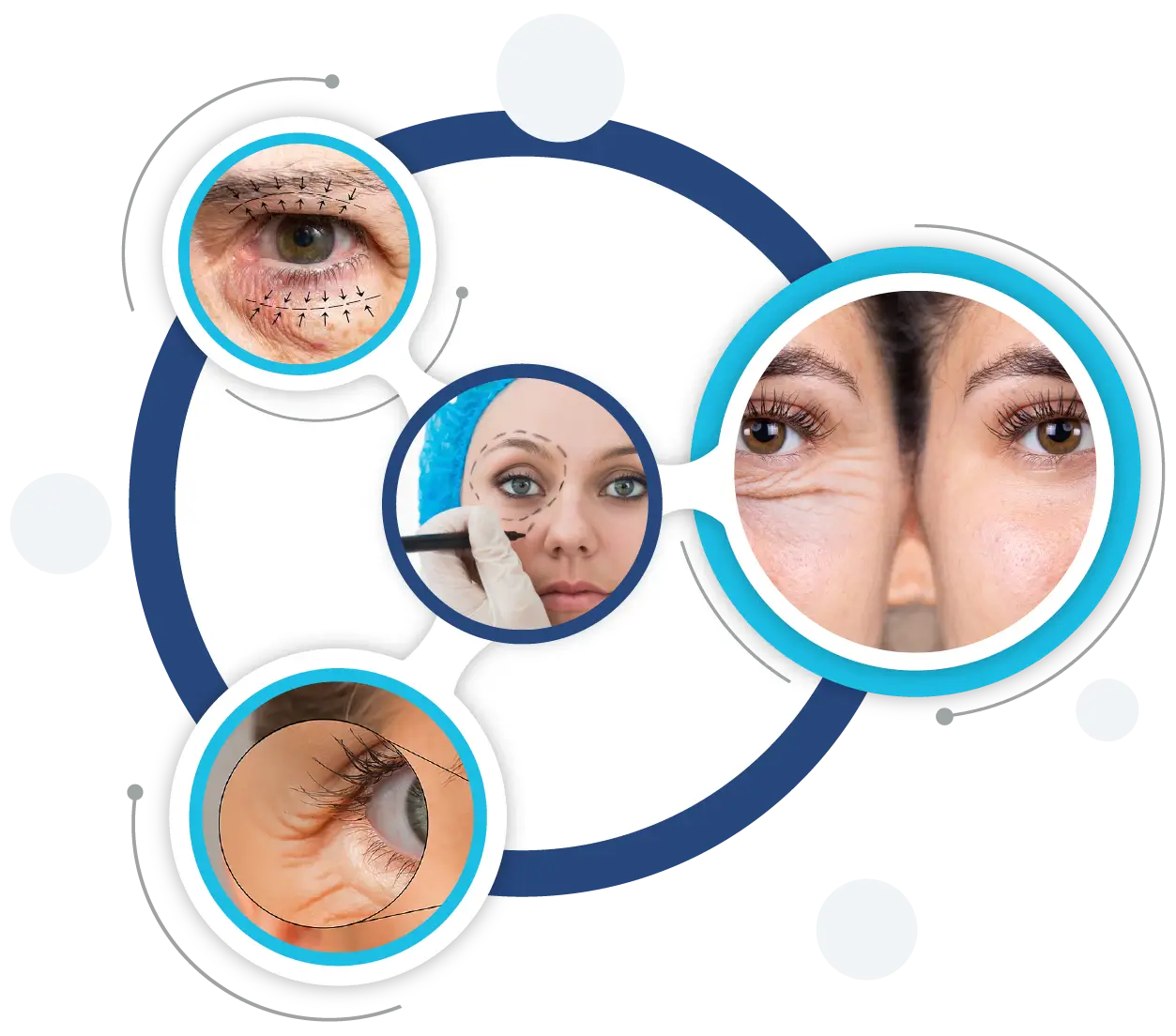 ophthalmic plastic surgery process