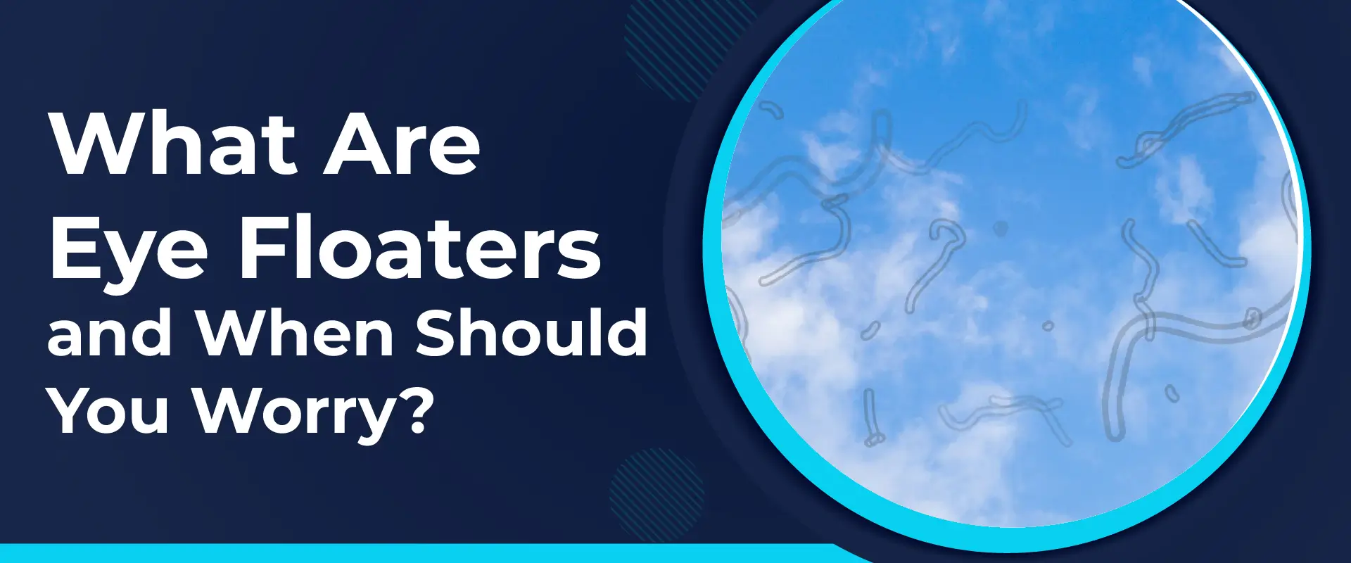 Eye floaters