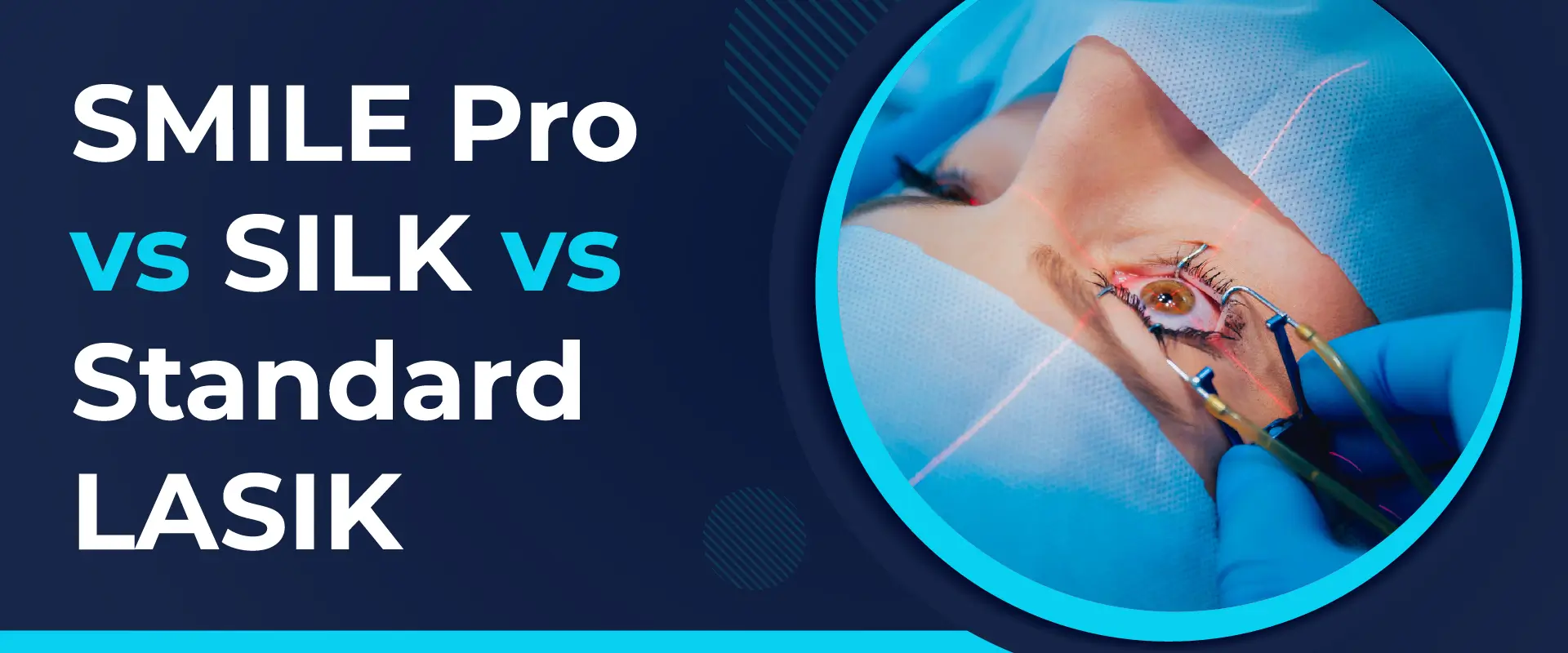 SMILE Pro vs SILK vs Standard LASIK