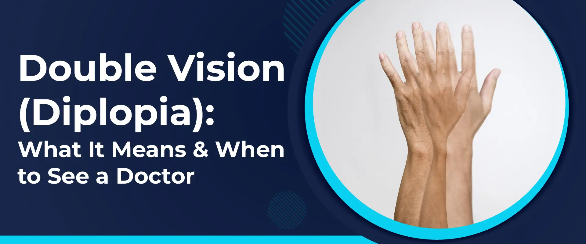 Double Vision Problem - Diplopia