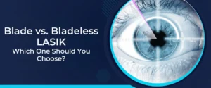 Blade vs. Bladeless LASIK Which One Should You Choose