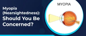 Myopia (Nearsightedness)