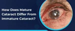 Immature vs. Mature Cataracts: Causes, Symptoms & Treatment