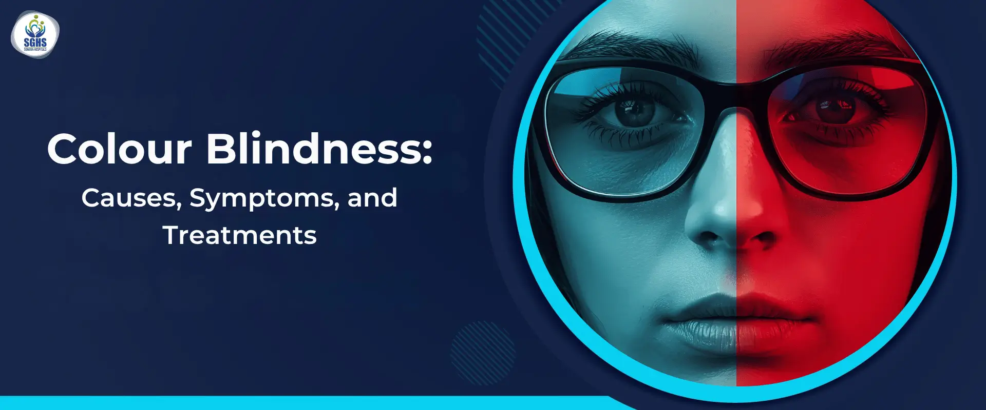 Colour Blindness Causes, Symptoms, and Treatments