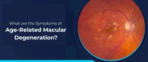 Symptoms of Age-Related Macular Degeneration
