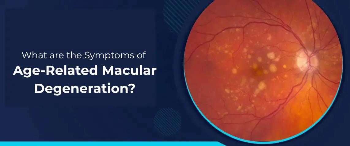 Symptoms of Age-Related Macular Degeneration