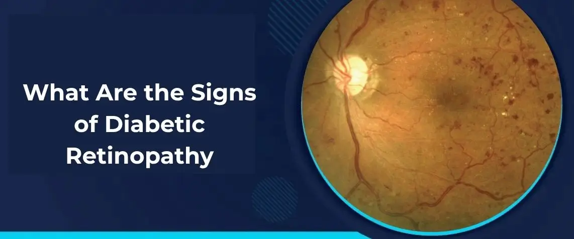 What Are The Signs Of Diabetic Retinopathy