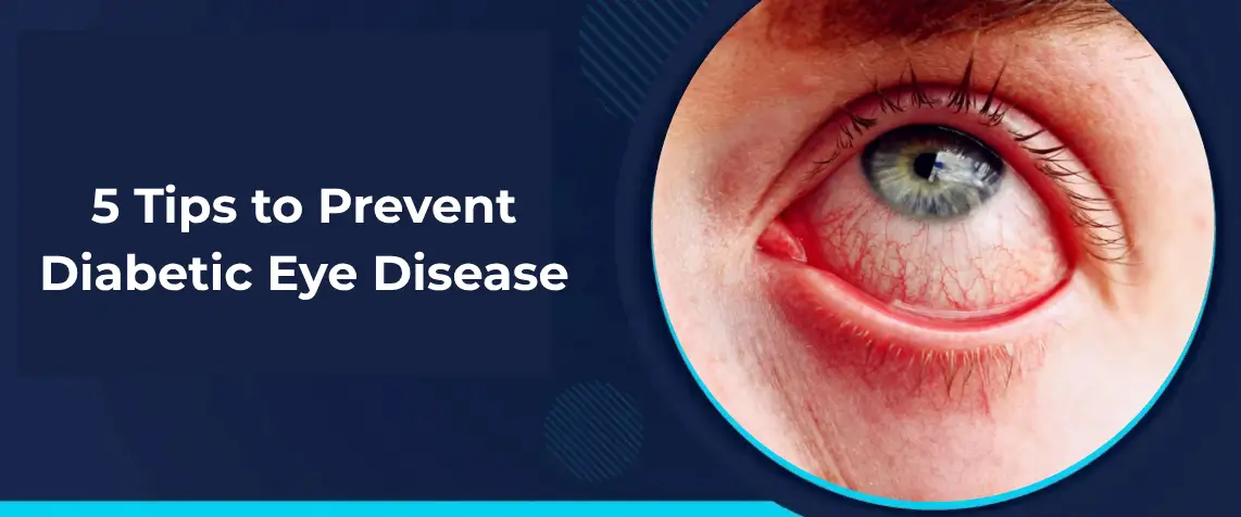 Tips to Prevent Diabetic Eye Disease