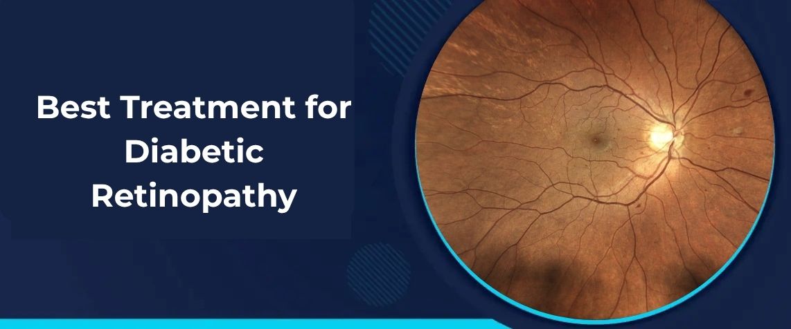 Best Treatment for Diabetic Retinopathy