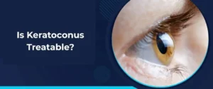 Is Keratoconus Treatable