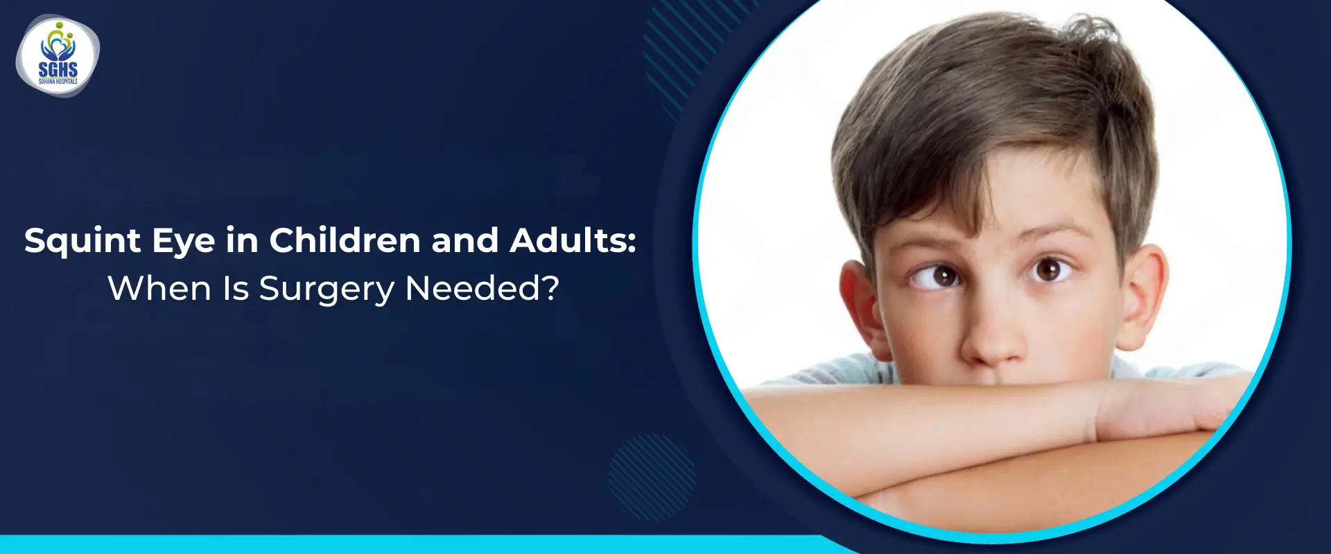 Squint Eye in Children and Adults - When Is Surgery Needed