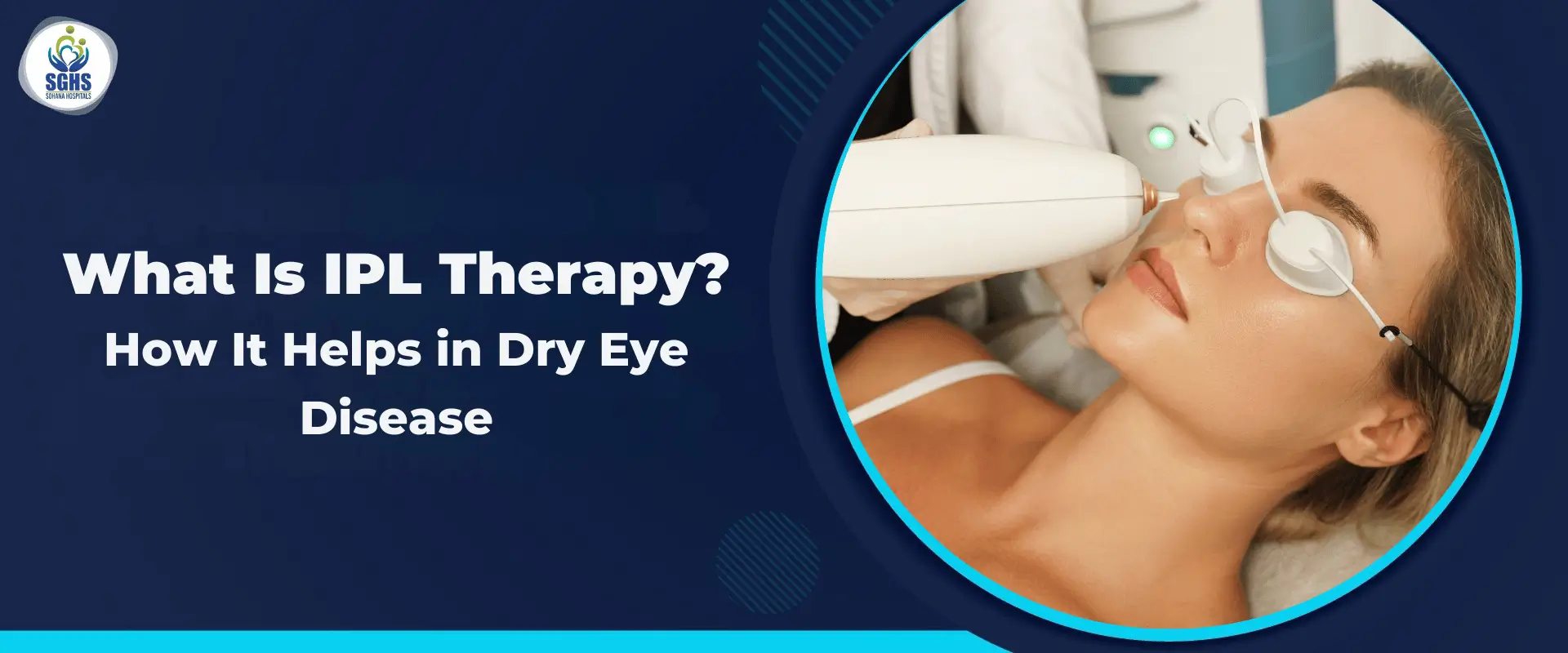 What Is IPL Therapy - How It Helps in Dry Eye Disease