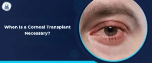 When Is a Corneal Transplant Necessary