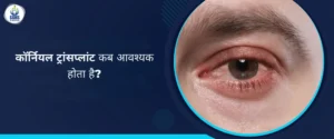 कॉर्नियल ट्रांसप्लांट कब आवश्यक होता है