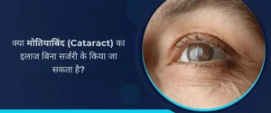 क्या मोतियाबिंद (Cataract) का इलाज बिना सर्जरी के किया जा सकता है?