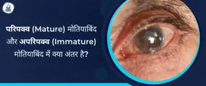 परिपक्व (Mature) मोतियाबिंद और अपरिपक्व (Immature) मोतियाबिंद में क्या अंतर है?