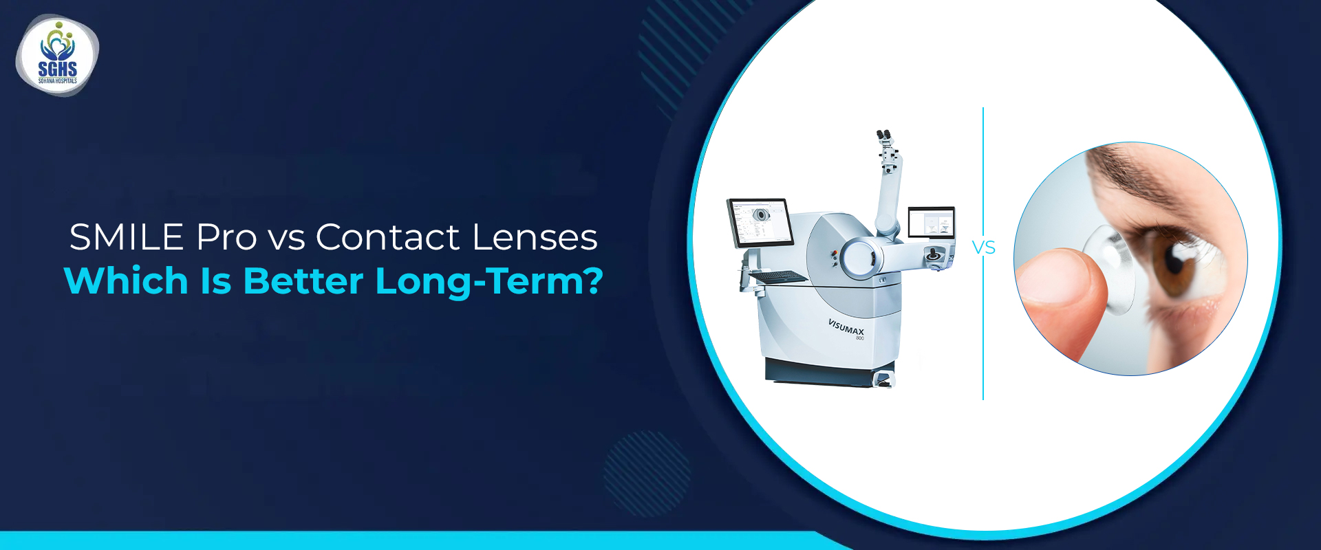 SMILE Pro Vs Contact Lenses