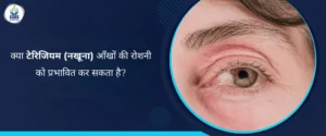 क्या टेरिजियम आँखों की रोशनी को प्रभावित कर सकता है