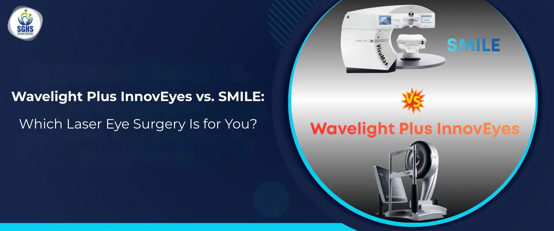 Wavelight Plus InnovEyes vs. SMILE