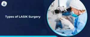 Types of LASIK Surgery