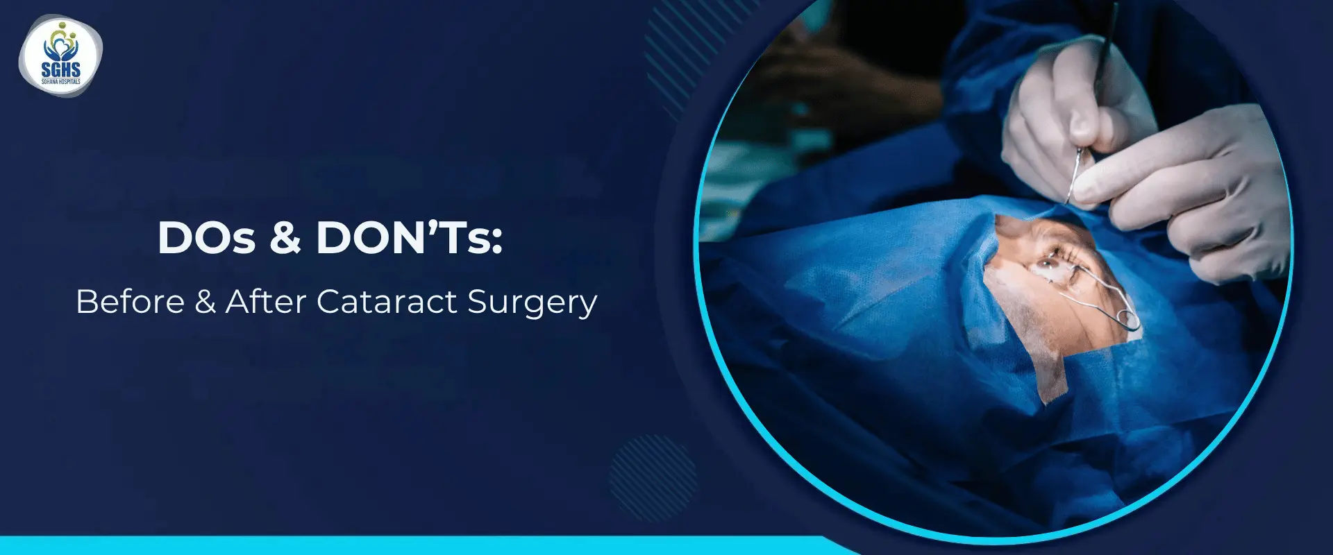 DOs & DON’Ts: Before & After Cataract Surgery