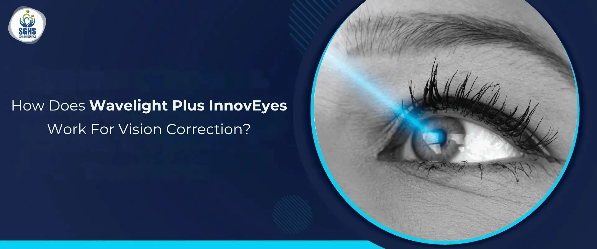 How Does Wavelight Plus InnovEyes Work For Vision Correction