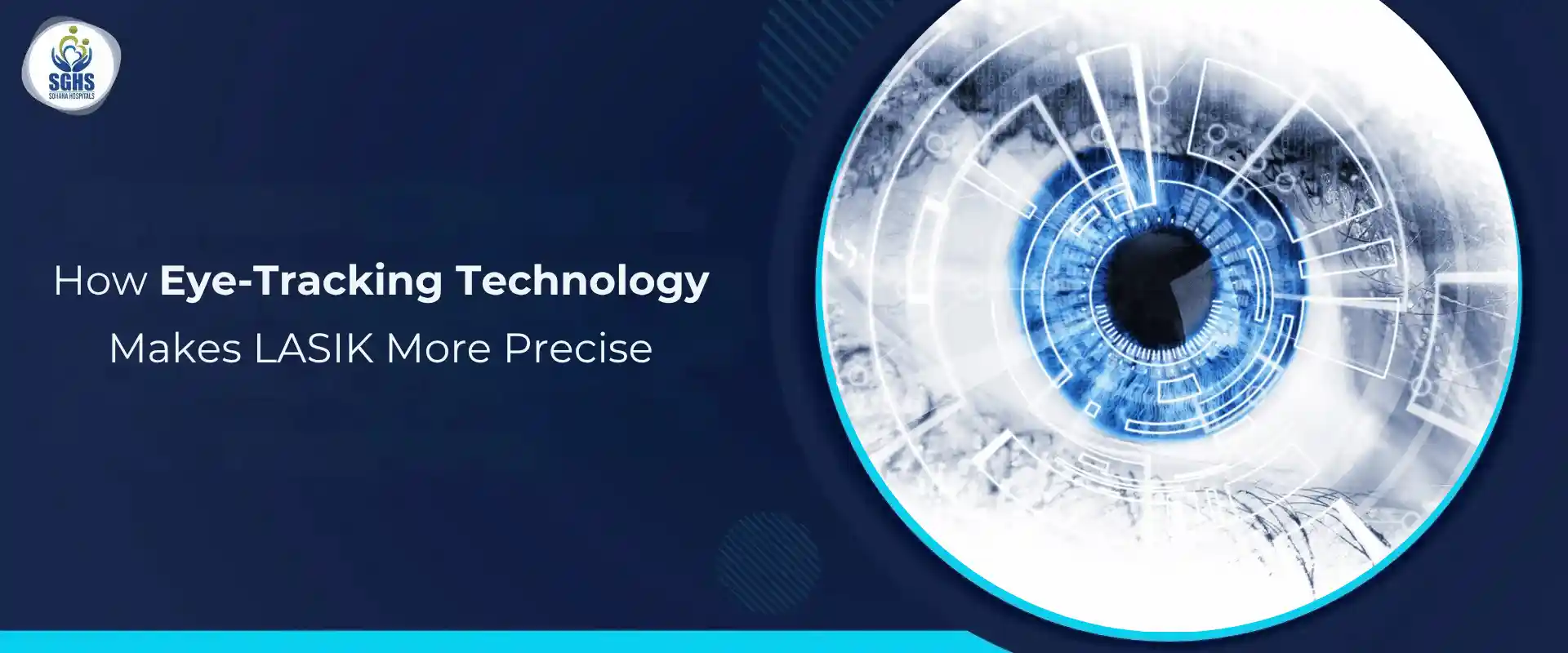 How Eye-Tracking Technology Makes LASIK More Precise