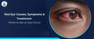 Red Eye Causes, Symptoms & Treatment