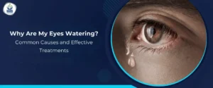 Why Are My Eyes Watering - Common Causes and Effective Treatments
