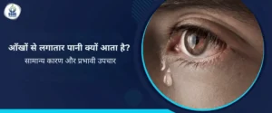 आँखों से लगातार पानी क्यों आता है - सामान्य कारण और प्रभावी उपचार