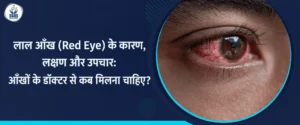 लाल आँख (Red Eye) के कारण, लक्षण और उपचार - आँखों के डॉक्टर से कब मिलना चाहिए
