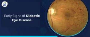 Early Signs of Diabetic Eye Disease