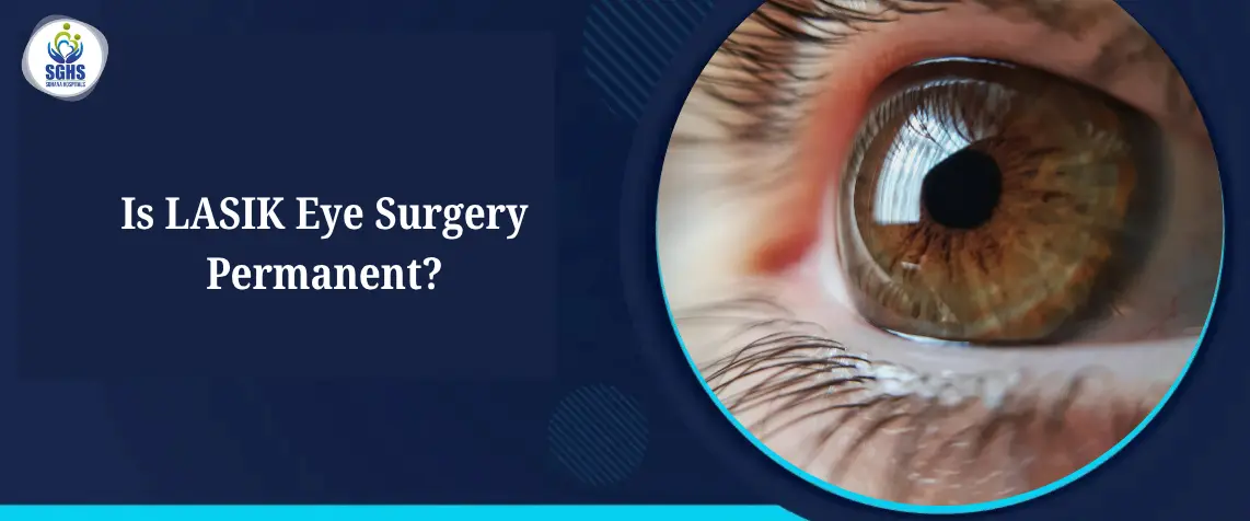 Is LASIK Eye Surgery Permanent