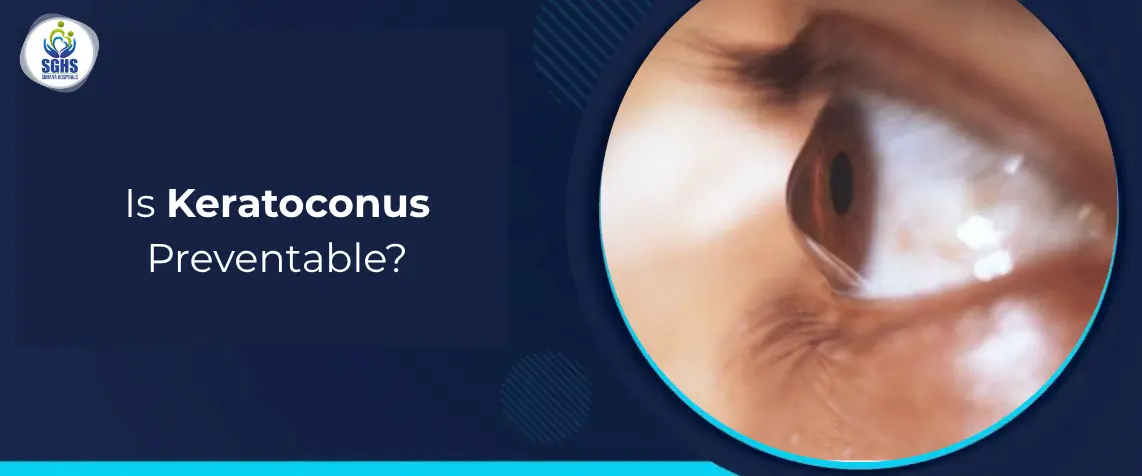Is Keratoconus Preventable