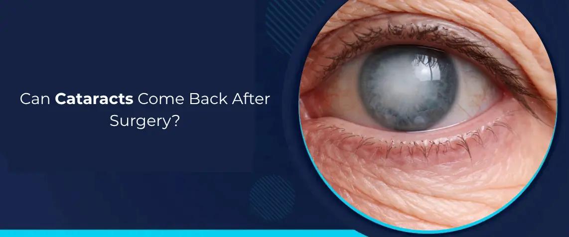 Can Cataracts Come Back After Surgery